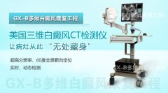 ������ά����CT