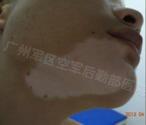 ���԰���ʲôʱ�����ƺ���