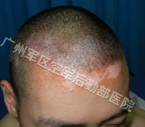 Ů�԰��综��Ҫע��ʲô��