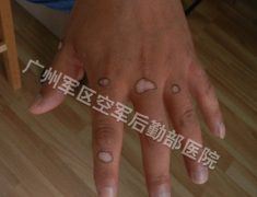 �ֱ��ϵİ���Ҫ��λ�����