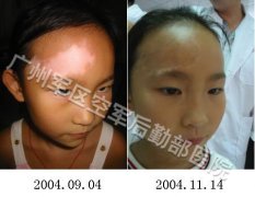 ���ƶ�ͯ��������Щ������