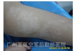 ˫�۰���Ҫע��ʲô��