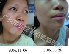 ���综��������Ҫע��ʲô