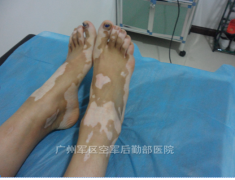 ����֫���Ͱ����Ĵ�ע������