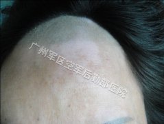 ���综�����ѡ���ڸ�Һ��