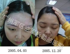 ���综�����罻�ϰ���ô��