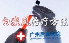 ���综������Ҫע��ʲô