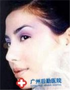 Ů���沿������Է���Ĥ��