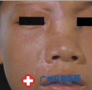 ��ͯ���˰���������������