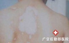 �ﶬ�����综������Ԥ��