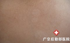 �����֢״����ʲô