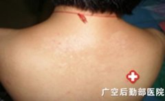 Ů�԰���Ҫע��ʲô