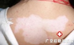 ���������Σ������Щ