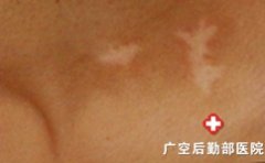 �����˻��ϰ�����������