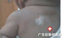 ��ͯ���ϰ������ô����