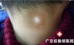 ���ڰ�������ʲô����֢״