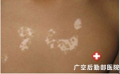 ���ϰ�����ʲô֢״����