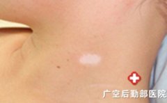 ��������Ҫע����Щ����