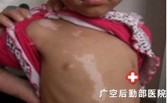 ���综���ز������Ԥ��