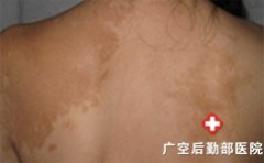 �������������֢״������ʲô