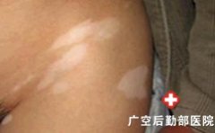 ʲô���ص��°��縴����