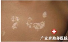 ���糣����֢״����