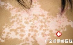 ���������ߴ�����Щ�˺�