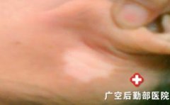 �������ڶ�ͯ��������