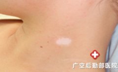 ��ô���������������װ�