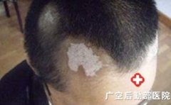 ͷ��������ν���ͷ������