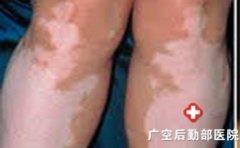 ���综���������������̬