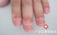 �������ָ���ϵİ���