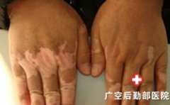 Ů���ֲ�����Щ����֢״