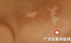 ���������˰�����ô��