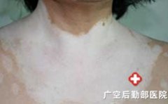 �������ٴ�������Щ����