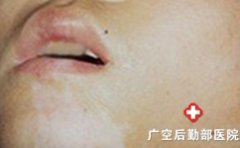 �и����综��Ҫע��ʲô��ʳϰ��