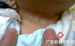 ���¶�ͯ�����׷���ԭ������Щ