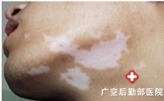 ���综������������Ҫ��ô��