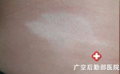 �����Ͱ��综�����̺Ⱦ���ʲôΣ��