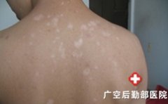 �ഺ�ڰ��综������Щ����