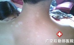 Ϊʲô�����ϳ����װ�