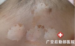 �����Σ��������Щ